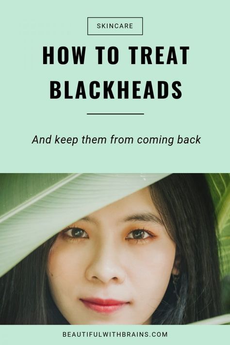 How To Treat Blackheads (And Keep Them From Coming Back) How To Treat Blackheads, How To Prevent Blackheads, Skincare Acne, Cold Sores Remedies, Natural Sleep Remedies, Natural Cold Remedies, Natural Cough Remedies, Cold Home Remedies, Simple Skincare