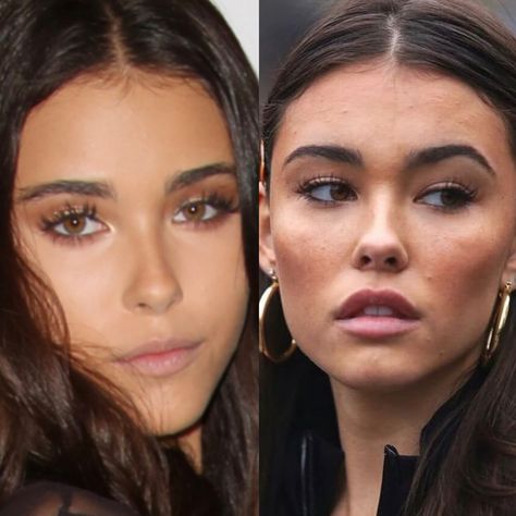 Madison Beer natural face and after surgery face Eyebrows Before And After, Madison Beer Plastic Surgery, Eyebrow Before And After, Madison Beer, Plastic Surgery, Natural Makeup, Surgery, Eyebrows, Beer