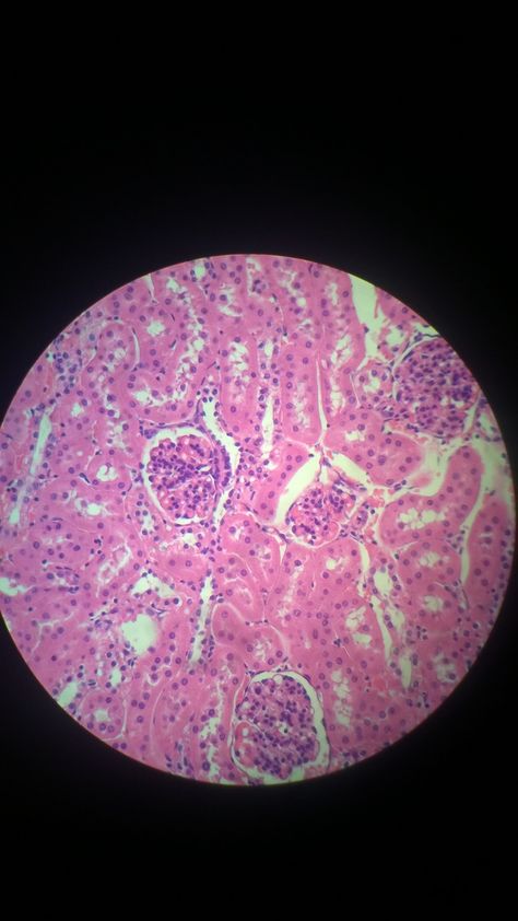 simple squamous epithelium Simple Squamous Epithelium, Squamous Epithelium, Anatomy Lab, Anaerobic Respiration, Histology Slides, Skull Anatomy, Science Rules, Med School Motivation, Medical Laboratory Science