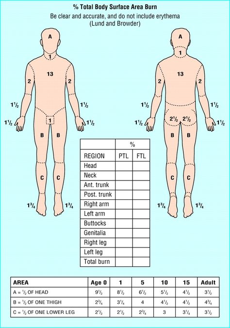 Rule of 9's burn chart Rule Of Nines, Nclex Study Guide, Body Chart, Integumentary System, Student Info, Medical Oncology, Acute Care, Forensic Science, Medical Coding