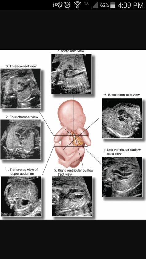 Ultrasound Technician Aesthetic, Technician Aesthetic, Sonography Humor, Diagnostic Medical Sonography Student, Ultrasound School, Obstetric Ultrasound, Cardiac Sonography, Sonography Student, Ultrasound Sonography