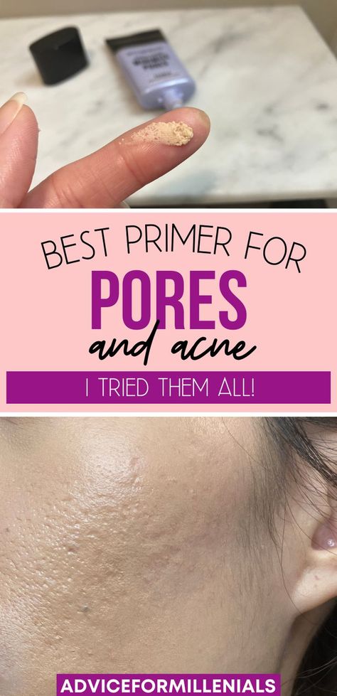 Best primer for pores and acne. I tried them all! Best Primer For Pores, Primer For Acne Prone Skin, Acne Prone Skin Makeup, Best Makeup For Acne, Makeup For Acne, Best Primer For Oily Skin, Skin Care Hyperpigmentation, Primer For Oily Skin, Best Makeup Primer