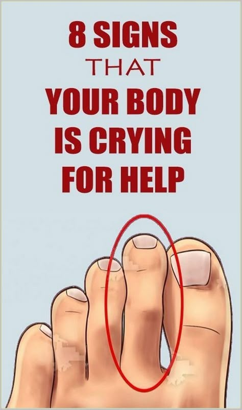 8 Signs That Your Body Is Crying Out For Help Best Probiotics For Women, Probiotics For Women, What Is Health, Healthy Facts, Health Signs, 8th Sign, Daily Health Tips, Natural Health Tips, Health Habits