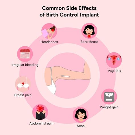 Common side effects from birth control i... | Premium Vector #Freepik #vector #concept #information #healthcare #medication Contraceptives Poster, Implant Birth Control, Birth Control Implant, Pregnancy Side Effects, Biology Poster, Medical Study, Contraception Methods, Contraceptive Pill, Pumping Breastmilk