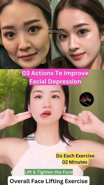 Facial Yoga Exercises, Face Lift Exercises, Mouth Wrinkles, Face Fitness, Tighten Facial Skin, Anti Aging Remedies, Exercise Daily, Natural Face Lift, Face Yoga Exercises