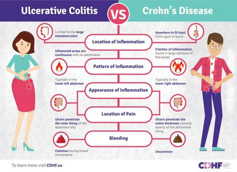 Ulcerative Colitis vs Crohn's Disease: What's the Difference? Infographic - Canadian Digestive Health Foundation Gastrointestinal Nursing, Ibd Awareness, Pathophysiology Nursing, Chrons Disease, Irritable Bowel Disease, Nurse Teaching, Gastric Problem, Nursing School Essential, Inflammatory Bowel