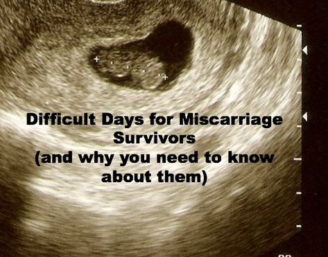 October 15th Pregnancy Loss, Misscarage Tattoo Ideas, Fertility Smoothie, Getting Pregnant Tips, Losing A Baby, Helpful Advice, Infant Loss Awareness, Ectopic Pregnancy, Pregnancy And Infant Loss