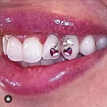 ˖ ࣪ 𝜗𝜚 on X: "i need these so bad https://t.co/qcUD7qfXWW" / X Cherry Tooth Gem, Teeth Gems Ideas, Tooth Gems Aesthetic, Teeth Gems, Pretty Teeth, Grillz Teeth, Diamond Teeth, Dope Jewelry Accessories, Tooth Gems