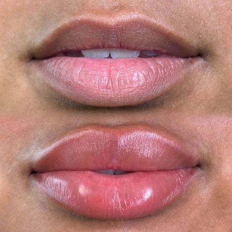 . . . . . . . . . . #lips #lipblushing #pmuartist #raleighnc #raleighlipblush #cosmetictattoo #naturalpmu #neutralization #ncbrows #microbladingraleigh #raleighlipfiller #lipstick #lipcolor Lip Blushing Brown Skin, Lip Filler Inspo 0.5ml, Microblading Lips, Lip Blush Tattoo Before And After, Full Pouty Lips, Lip Neutralization Before And After, Lip Filler Before And After Black Women, Keyhole Pout Lips, Lip Blushing Black Women