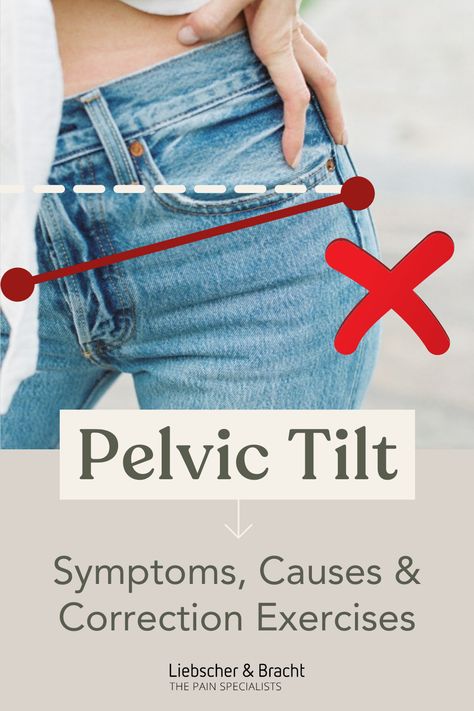 Do you feel out of balance? Do you experience pain throughout your body or even have new issues arising from time to time? Well, the reason could be down to a pelvic tilt. In this article, we'll explain exactly what this is, share the causes, symptoms and, of course, the correct stretching exercises to help realign your body and leave you feeling great! 🧘‍♂️🤸‍♀️ So why not start your pain-free journey today and give our exercise workout a try! 🥰 Pelvic Tilt, Stretching Exercises, Do You Feel, Back Pain, Stretching