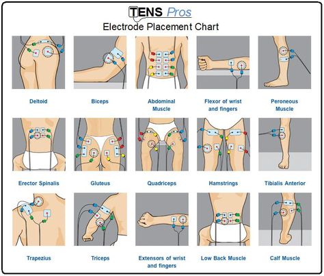 TENS unit electrode placement chart for different sports/life injuries. Tens Electrode Placement, Tens Unit Placement, Tens And Units, Tens Machine, Tens Unit, Tens Ems, Ten Unit, Muscle Stimulator, Hand Therapy