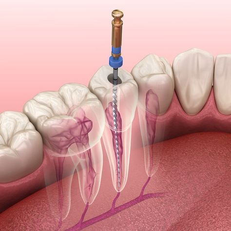 Dental Images, Dental Posters, Dental Videos, Aesthetic Dentistry, Dental Emergency, South Delhi, Dental Logo, Emergency Dentist, Tooth Pain