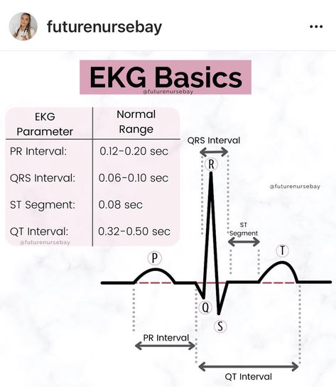 Nurse Vocabulary, Heart Physiology, Doctor Stuff, Er Tech, Ekg Interpretation, Pr Interval, Ed Nurse, Nursing Cheat, Medical Notes