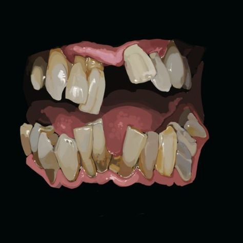 Teeth Art, Human Reference, Favorite Artist, Arte Inspo, Anatomy Art, Art Studies, Art Block, Funky Art, Art Tips