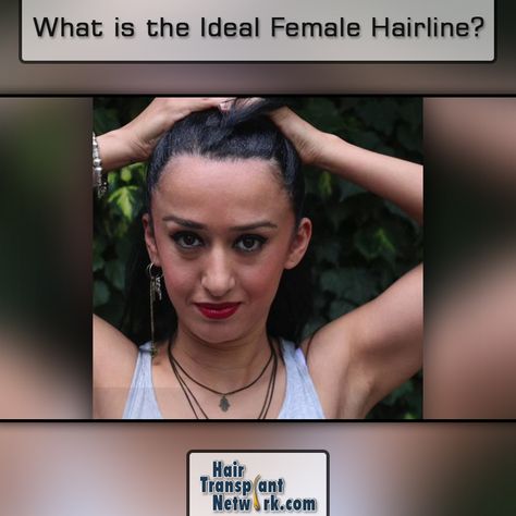 #Some #women have #naturally #high #foreheads and wish they could #lower #their #hairline. Well, this procedure exists and top #hair #transplant #surgeons have #helped #thousands of #women achieve their #goals. Forehead Reduction, High Forehead, Sewing Ideas Clothes, Increase Engagement, Womens Hairstyles, Health And Wellness, Beauty Hacks, Hair Hair, Fashion Tips