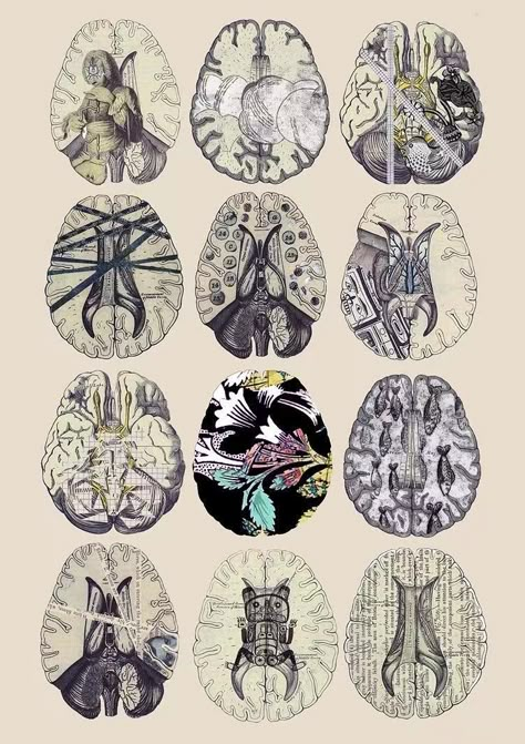 Brain Scan Aesthetic, The Brain Aesthetic, Brain Wallpaper, Brain Aesthetic, Mind Aesthetic, Med Wallpaper, Neuroscience Art, Brain Scans, Over Thinking