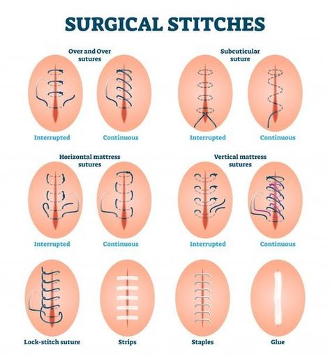 Surgical Stitches, Surgical Technologist Student, Medical Terminology Study, Surg Tech, Studera Motivation, Surgical Technologist, Nursing Student Tips, Medical School Life, Nursing School Motivation