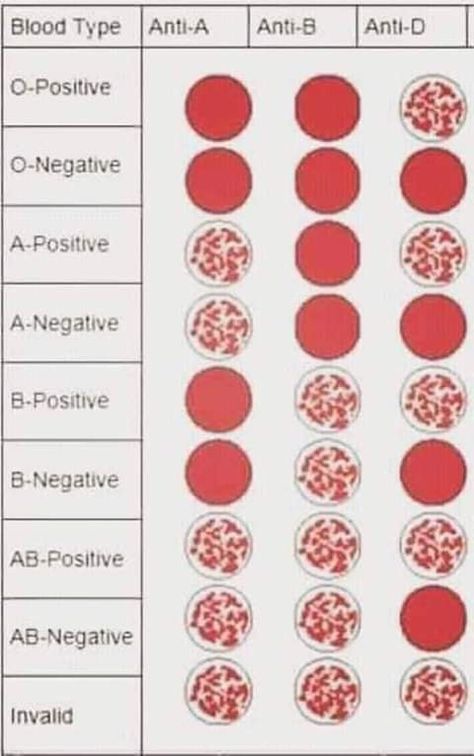 Hematology Aesthetic, Blood Type Chart, Medical Laboratory Science Student, Nursing Labs, Medical Lab Technician, Medical Assistant Student, Blood Types, Type Chart, Medical School Life