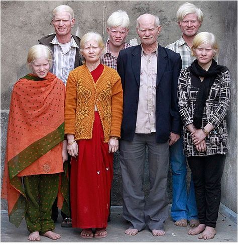 Albino Indians Caucasian Race, Family World, Indian Family, Albino Animals, People Of The World, 인물 사진, New Delhi, People Around The World, A Group