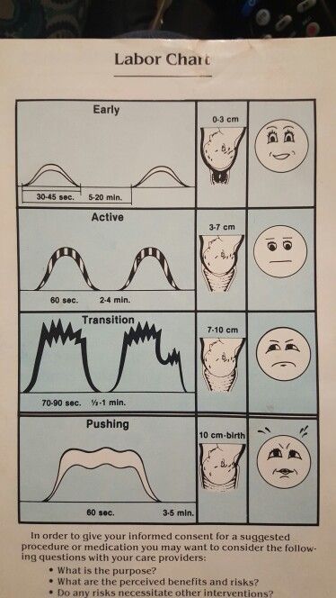 Stages Of Labor Chart, Stages Of Labor Chart Natural Birth, Tips For Smooth Labor, Inducing Labor At Home, Inducing Labor, Labor Inducing, Antenatal Classes, Nursing Instructor, Midwifery Student