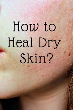 Tips to heal dry and itchy skin. Dry Skin Makeup, Brown Spots On Skin, Healing Dry Skin, Extremely Dry Skin, Dry Skin On Face, Dry Skin Remedies, Combination Skin Type, Dry Itchy Skin, Skin Spots