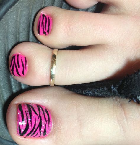 Y2k Pedicure Ideas, 2000s Toe Nail Designs, Zebra Toe Nail Designs, 2000s Toe Nail Art, Hot Pink Zebra Nails, Goth Toe Nails, Y2k Pedicure, Y2k Toenails, Zebra Pedicure