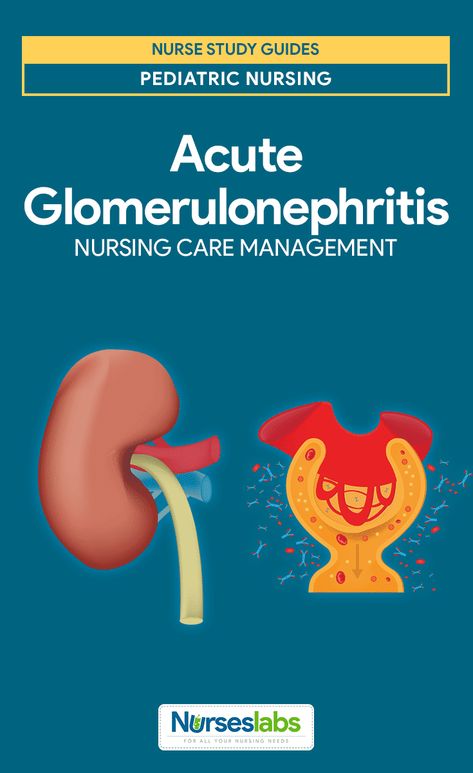 Acute Glomerulonephritis Glomerulonephritis Nursing, Acute Glomerulonephritis, Nursing Finals, Nurse Goals, Renal System, Basement Membrane, Nursing 101, Nursing Cheat, Nclex Prep