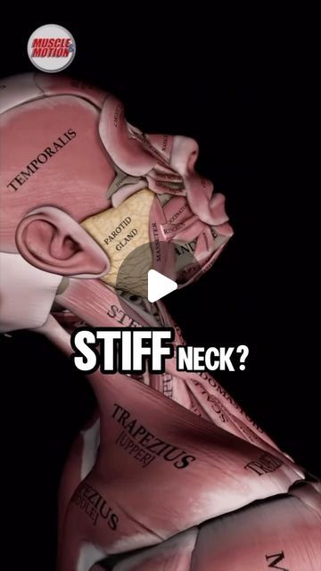 Neck Stretches For Stiff Neck, Squat University, Parotid Gland, Exercises For Strength, Shoulder Rehab, Tech Neck, Getting Stronger, Stiff Neck, Workouts Exercises