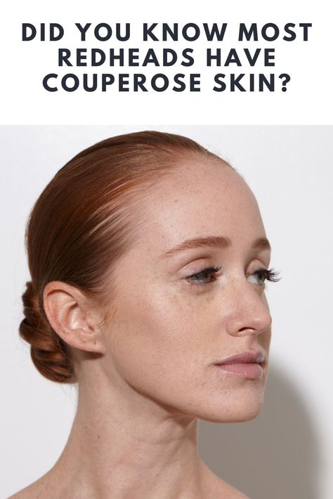 Did You Know Most Redheads Have Couperose Skin? Redhead Color Analysis, Colors For Red Heads To Wear, Color Palette For Redheads, Red Head Makeup Natural, Best Clothing Colors For Gingers, Clothing Colors For Redheads, Blending Gray Hair Redhead, Redhead Color Palette, Lipsticks For Redheads