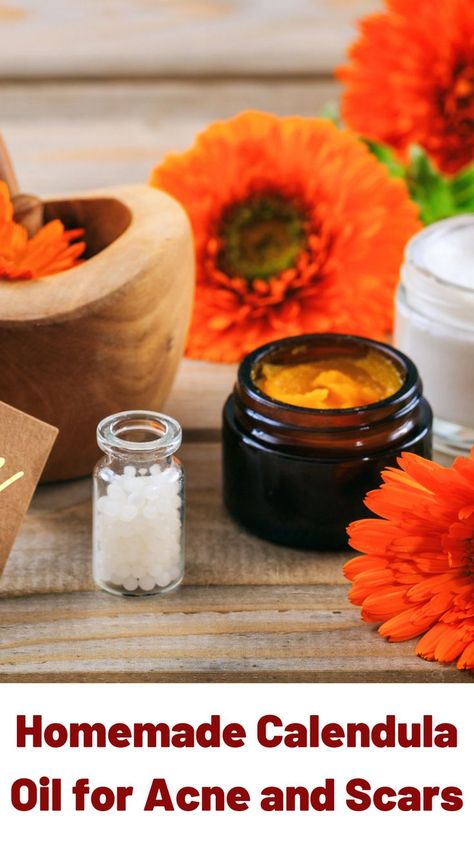 Herbal Mixtures, Tallow Balm, Calendula Cream, Lotion For Oily Skin, Calendula Benefits, Oily Skin Acne, Oil For Skin, Calendula Oil, Skin Care Wrinkles