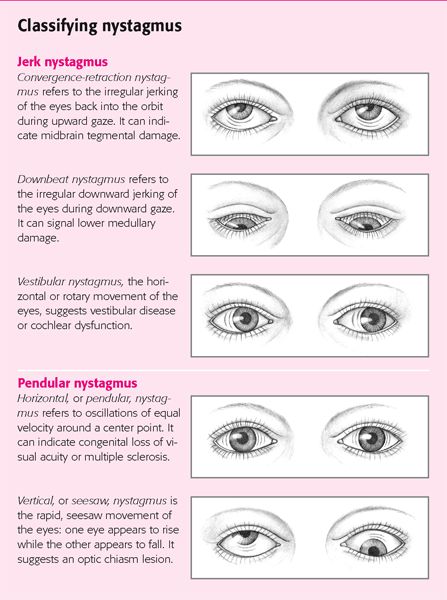 Opthalmic Technician, Optometry Education, Eye Conditions, Eye Facts, Eye Anatomy, Vision Therapy, Eyes Problems, Qi Gong, Medical Knowledge