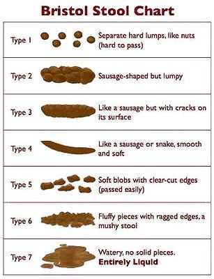 Bristol Stool Chart | Here's a chart to tell you if your sto… | Flickr Bowel Movement Chart, Bristol Stool, Stool Chart, Bristol Stool Chart, Healthy Bowel Movement, Stool Softener, Chronic Constipation, Bowel Movement, Colon Cleanse