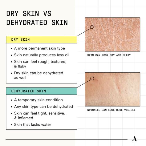 Skin Problems Types Of, Functions Of The Skin, Structure Of Skin, How To Know What Your Skin Type Is, How To Identify Skin Type, Skin Types Chart, Dry Skin Type, Remove Skin Tags, Skin Cycling