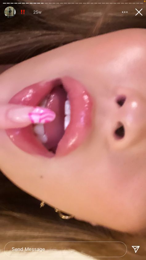 Lip Pictures Aesthetic, Holly Lim, Lip Pictures, Lips Photo, Model Aesthetic, Lip Fillers, Instagram Inspo, Insta Photo Ideas, Just Girl Things