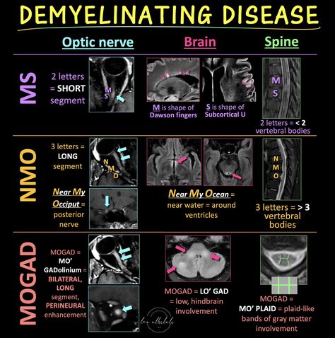 Lea Alhilali, MD (@teachplaygrub) on X Brain Mri, Demyelinating Disease, Medical Radiography, Mri Technologist, Mri Brain, The Cheat Sheet, Optic Nerve, Medical School Studying, 2 Letter