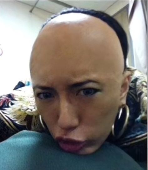 Skullet Haircut, W Rizz, Bad Eyebrows, Forced Haircut, Undercut Long Hair, Shaved Undercut, Bald Girl, Bald Hair, Bald Women