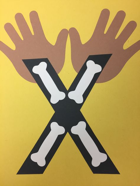 Preschool X Crafts, X Is For X Ray Preschool, X Is For Craft Preschool, Preschool Letter X Activities, X Is For Craft, Letter E Preschool Crafts, X Is For, W Is For, R Crafts For Preschool