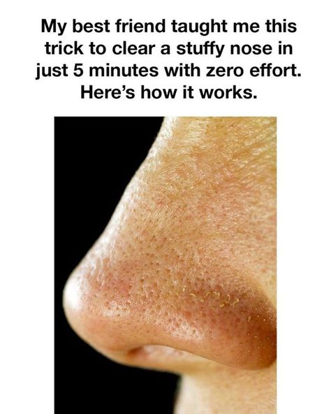 Tips for the Home What To Do For Stuffy Nose, How To Fix A Stuffy Nose, Stuffed Nose Remedy, How To Clear A Stuffy Nose, Stuffy Nose Remedy Fast, Stuff Nose Remedies, Stuffed Nose, Clear Stuffy Nose, Congested Nose