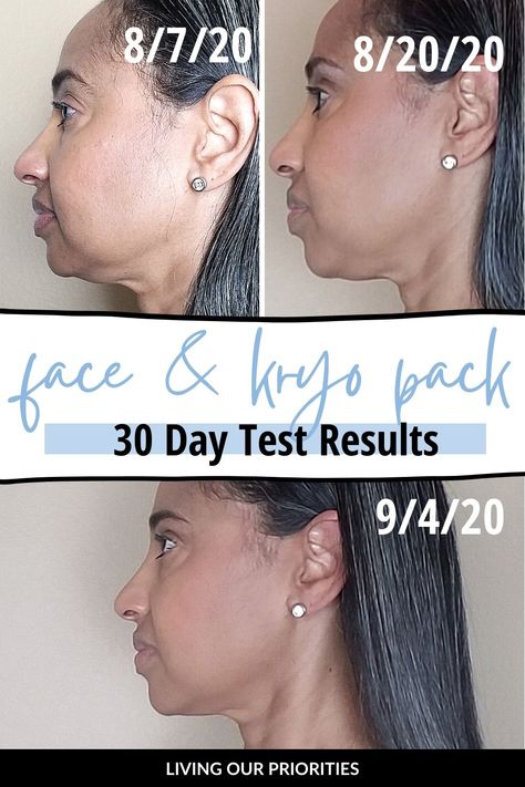 Fascia Blasting How To, Fascia Blasting Face Before And After, Facia Blasting Before And After, Fascia Blaster Before And After, Fascia Health, Ashley Black Fascia Blaster, Face Blaster, What Is Fascia, Fascia Blasting