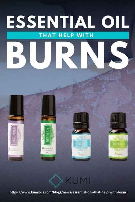 Essential Oil For Burns, Soothing Face Mask, Treat Burns, Skin Burns, Essential Oil Diffuser Blends, Oil Diffuser Blends, Best Essential Oils, Wellness Fitness, Diffuser Blends