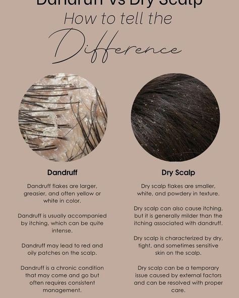 Let me help you treat your dandruff and dry scalp Itchy Dry Scalp Remedy, How To Remove Dandruff, Dry Scalp Remedy, Natural Hair Maintenance, Dandruff Flakes, Dandruff Remedy, Dry Itchy Scalp, Clean Blackheads, Skin Patches