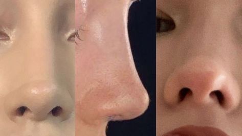 Front Nose Profile, Nose Vision Board, Nose Manifestation, Nose Claim, Button Nose Front View, Small Nose Aesthetic, Turned Up Nose, Slim Nose, Nose Surgery Rhinoplasty