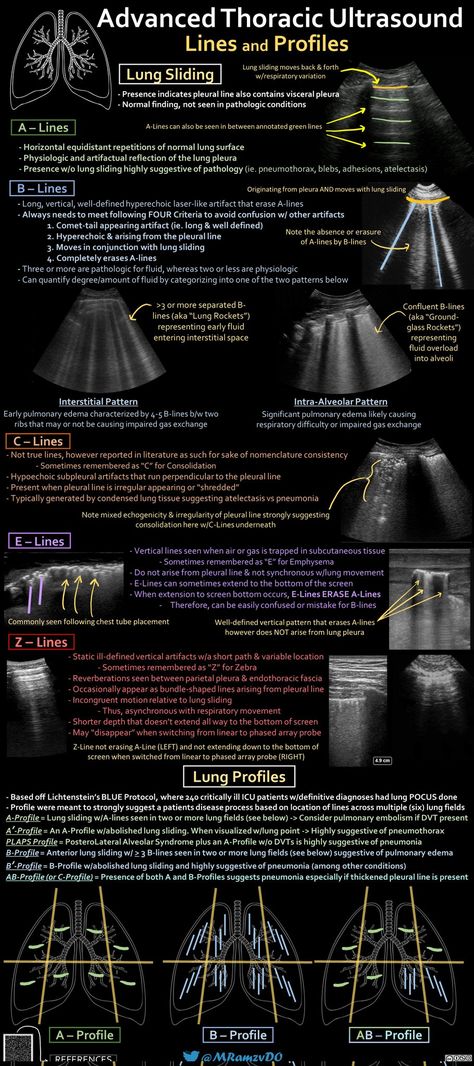 Home / Twitter Ultrasound Physics Study, Vascular Ultrasound Anatomy, Mri Vs Ct Scan, Diagnostic Medical Sonography Student, Ultrasound School, Diagnostic Radiography, Vascular Ultrasound Registry, Medical Radiography, Cardiac Sonography