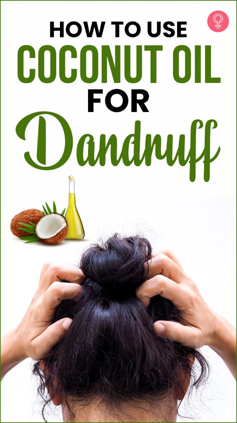 Wondering how to use coconut oil for dandruff? If yes, then you are on the right page. Read on to know more about coconut oil, its benefits, and how to use it. Coconut Oil For Dandruff, Coconut Oil Remedies, Natural Dandruff Remedy, Hair Mask For Dandruff, Coconut Oil Mask, Oils For Dandruff, Dandruff Remedy, Diy Coconut Oil, Coconut Oil Skin Care