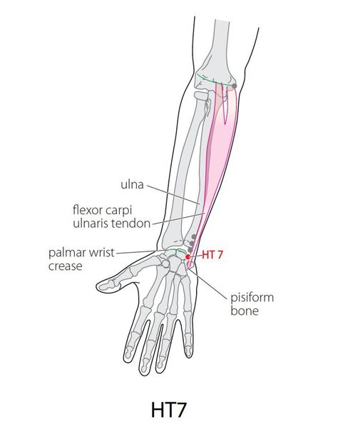 Tcm Traditional Chinese Medicine, Acupuncture Point, Meridian Points, Sleep Phases, Insomnia Causes, Chiropractic Wellness, Fire Element, Acupuncture Points, Acupressure Points