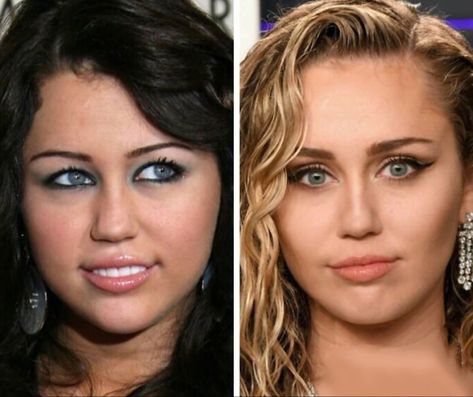 Miley Cyrus Before And After, Celebrity Plastic Surgery Before After, Plastic Surgery Celebrities, Celebrity Surgery, Plastic Surgery Fail, Plastic Surgery Gone Wrong, Dark Secrets, Celebrity Plastic Surgery, Under The Knife