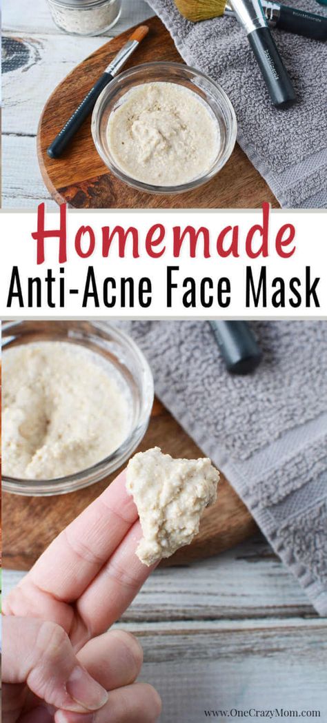 Do you struggle with acne but want an all natural product to use? We have an easy DIY Face Mask for Acne that will improve the appearance of your skin. #onecrazymom #acne #acnetreatment #acnetips #acnescars #acnescartreatment #facemask #diyfacemask #homemadefacemask Homemade Face Mask For Acne, Diy Face Mask For Acne, Acne Face Mask Recipe, Anti Acne Face Mask, Diy Acne Mask, Face Mask For Acne, Baking Soda Face Mask, Mask For Acne, Face Mapping Acne