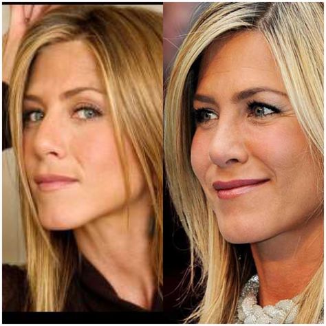 Jennifer Aniston nose job Jennifer Aniston Nose Job, Jennifer Aniston Nose, Rachel Haircut, Rhinoplasty Before And After, Expensive Beauty Products, Big Nose Beauty, Hair Evolution, Glamour Uk, Hollywood Gossip