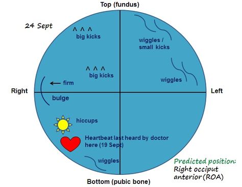 As we all know, a baby’s position in the womb influences the course of labour. The most optimal position for an easier and smoother birthing is left anterior occiput (LOA), with hands on the … Baby Mapping Belly, Belly Mapping Pregnancy, Transverse Baby, Doula Resources, Natural Birthing, Labor Tips, Baby In Womb, Bean Burrito, 31 Weeks Pregnant