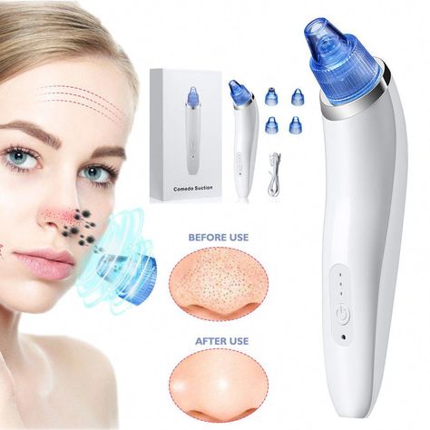 Blackhead Remover Blackhead Vacuum Suction Remover, USB Rechargeable Blackhead Comedo Vacuum Suction Facial Pore Cleanser Acne Extractor, Electric Skin Cleaner Blackhead Extraction Tool, Pore Cleanser with 4 Replaceable Suction Heads For Face and Body, Women and Men (White) 4 Different Heads: 1. Scrub Head: With more t Blackhead Extraction, Blackhead Vacuum, Clean Blackheads, Pore Cleaner, Prevent Pimples, Mole Removal, Pore Cleanser, Fine Wrinkles, Acne Cleansers